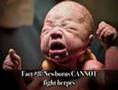 Top 10 Herpes Facts (Herpes #3)