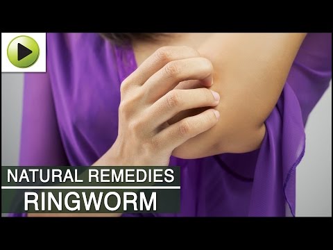 how to remove ringworm
