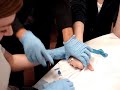 my first time starting an IV my first time starting an IV