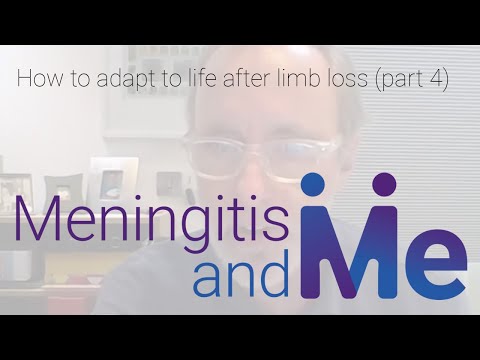 How to adapt to life after limb loss (part 4)