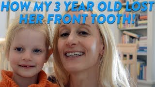 How My 3 Year Old Lost Her Front Tooth!  CloudMom