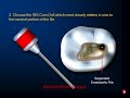 instrument removal system