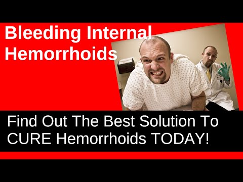 Bleeding Internal Hemorrhoids - Discover A Short Video About What They Are