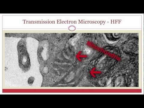 The Missing Genome: Mitochondrial DNA Deletions in Stem Cells