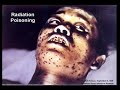 Effects of WMDs (Graphic Content) Effects of WMDs (Graphic Content)