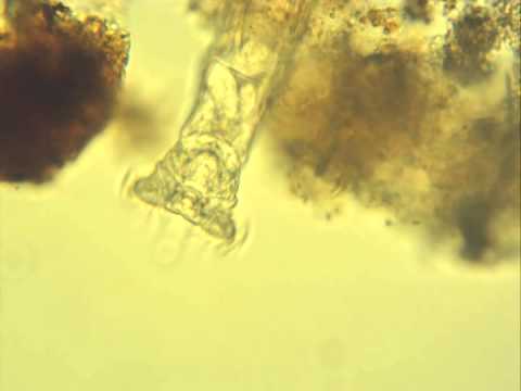 microscopic - microscopic creatures filmed in vermont 2012.