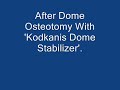 Dome Osteotomy With Kodkanis Dome stabilizer