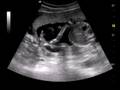 videos de Baby R - Arm in front of Face