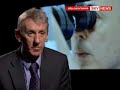 Sight-Saving Drug Now Available On NHS