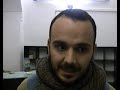 Abbattiamo le barriere Abbattiamo le barriere