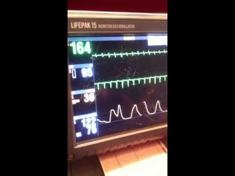 how to administer adenosine