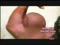 sterorider (steroids) Greg valentino
