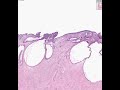 Shotgun Histology Cervix
