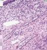 Shotgun Histology Cervix