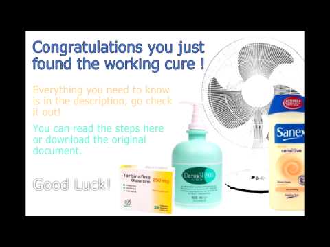 how to cure jock itch without cream