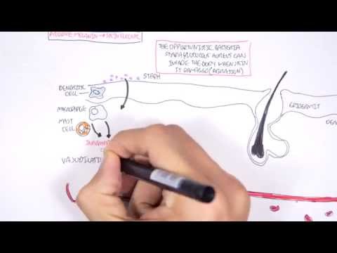 how to isolate staphylococcus epidermidis