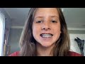 braces