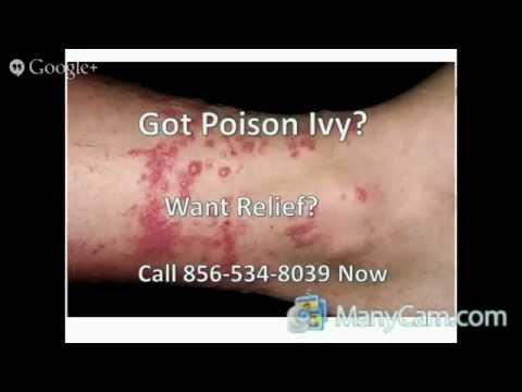 how to cure poison ivy fast