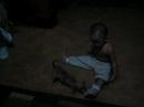DOG ATACKS CHILD
