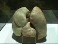 dead human bodies on display   voa story