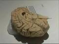Dead Human Bodies on Display - VOA Story