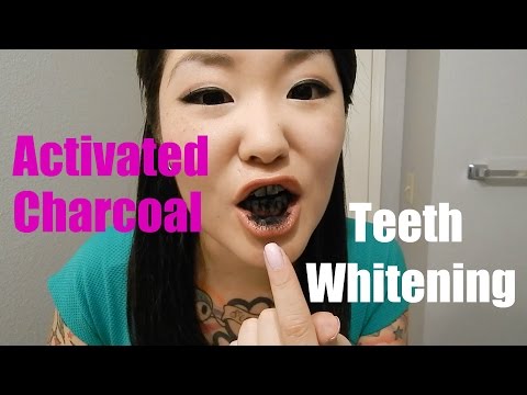 how to whiten asian teeth