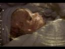 UltraSound Morph