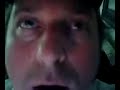 Real Insane Eye Trick ( No Editing or Fake Splitting)