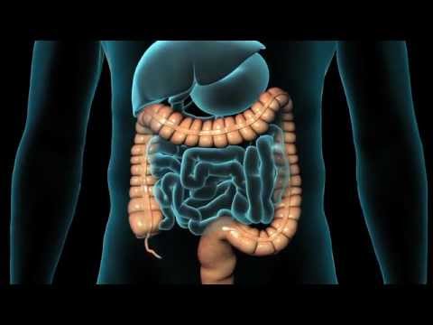 Retoscopia rígida - Veja como é realizado o exame de colonoscopia, quais suas indicações e cuidados. Mais informações em nosso site: http://www.clinicacedig.com.br.