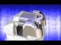 Damon Braces (Overview)