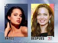 La cirug�a est�tica ya no es s�lo para los ricos