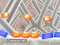 Osteoporosis-3D Medical Animation Osteoporosis-3D Medical Animation