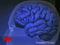 Doctor: Kennedy Brain Surgery 'successful'