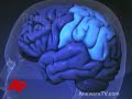 doctor-kennedy-brain-surgery-successful.html
