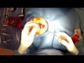 Open Rhinoplasty (Part 8) Dr. Naderi performs tip rhinoplasty sutures Washington DC & MD & VA