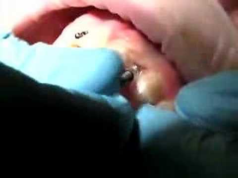See video
