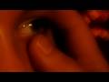 videos de Anti-Aids-Spot