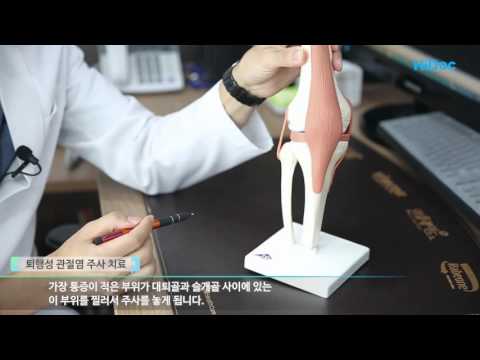 퇴행성 관절염이란