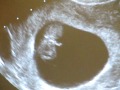 9 week ultrasound #1