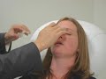 My Nose Surgery Results (Rhinoplasty)-Dr. Kim, Beverly Hills