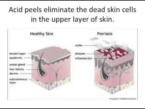 how to improve a skin tone