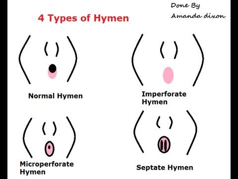 hymen