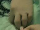 Tracheostomy in icu Tracheostomy in icu