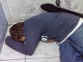 Muerte de ni�o por hemorragia profusa en fractura expuesta