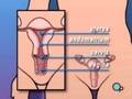 PreOp-Patient-Educat