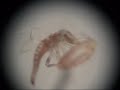 Larva y huevo de Neuroptera