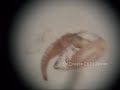Larva y huevo de Neuroptera