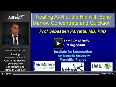 how to cure avascular necrosis