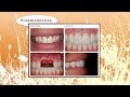Best Dentist in New Delhi India