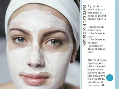 Home Remedies for Acne Scars